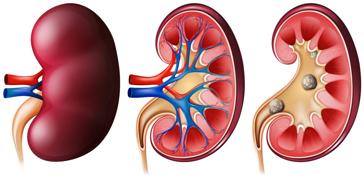 A set of 3 kidneys